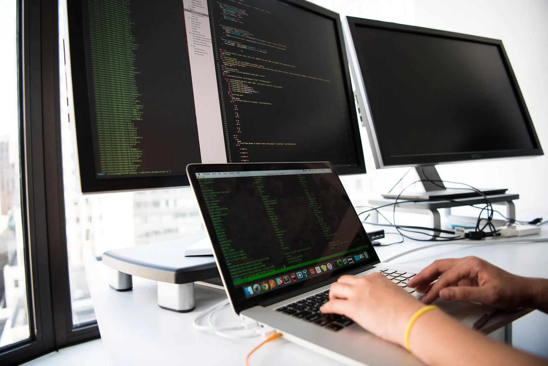 WordPress Web Development 15 close up photo of person typing on laptop